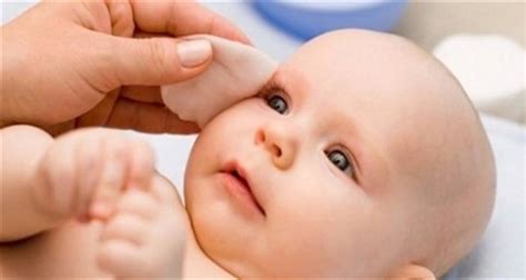 yeni doğan bebeklerde göz çapaklanması nasıl geçer